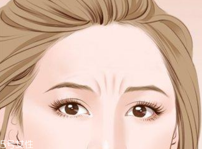 川字紋可以手術(shù)去除嗎？選擇手術(shù)需謹(jǐn)慎