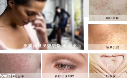 德國krauterhof蝸牛精華膏效果怎么樣？
