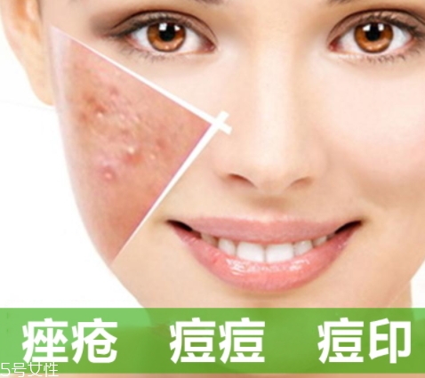 a酸怎么用？a酸怎么建立耐受？