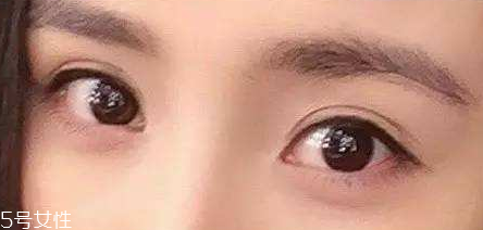 葉黃素能治療夜盲癥嗎？看什么類型的