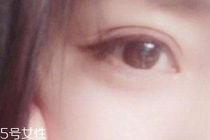 葉黃素一天吃多少毫克？按說明服用