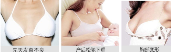 豐胸霜怎么用？豐胸霜使用手法詳解