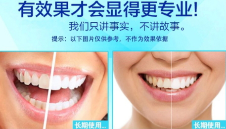 美白牙貼會反彈嗎？牙貼美白效果持續(xù)多久