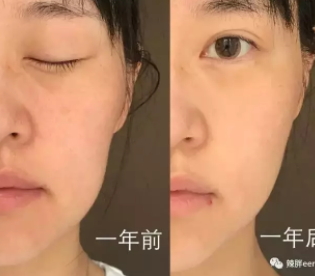 童顏機(jī)有用嗎？童顏機(jī)的功效