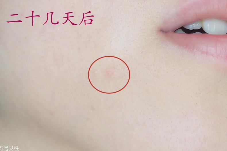 雅詩蘭黛晶透沁白防曬搖搖乳成膜快嗎？適合油痘皮嗎？