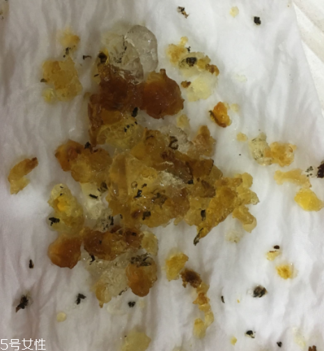 桃膠能和雞蛋一起吃嗎？桃膠配雞蛋可以嗎？