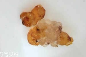 桃膠可以用開水泡嗎？用開水泡桃膠好嗎？