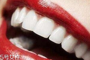 冷光美白會反彈嗎？冷光美白心得