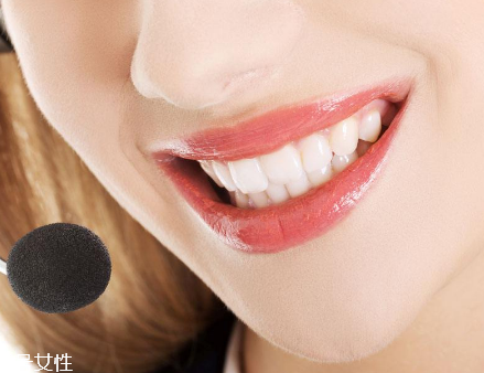 冷光美白會反彈嗎？冷光美白心得