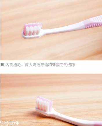 超聲波潔牙牙齒會(huì)變白嗎？超聲波潔牙心得