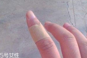 創(chuàng)可貼可以消腫嗎？創(chuàng)可貼有消腫功效嗎？