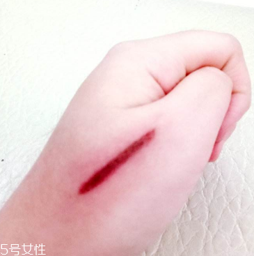 創(chuàng)可貼和肉連著怎么辦？創(chuàng)可貼連著肉怎么處理？