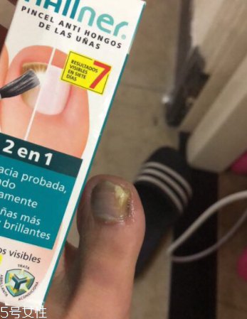 灰甲清有副作用嗎？灰甲清有哪些副作用？