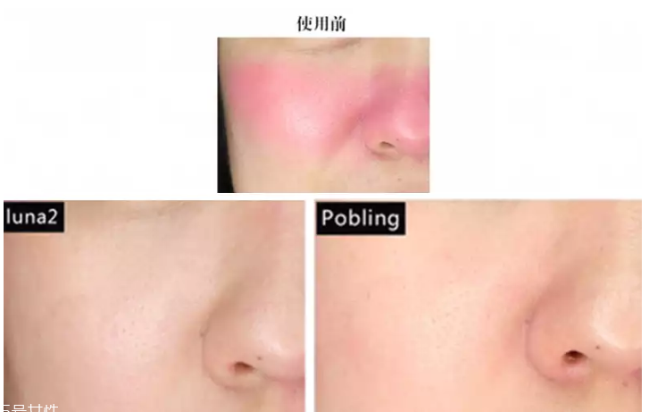 pobling和luna哪個(gè)好 pobling震動(dòng)潔面儀和luna mini2對(duì)比評(píng)測