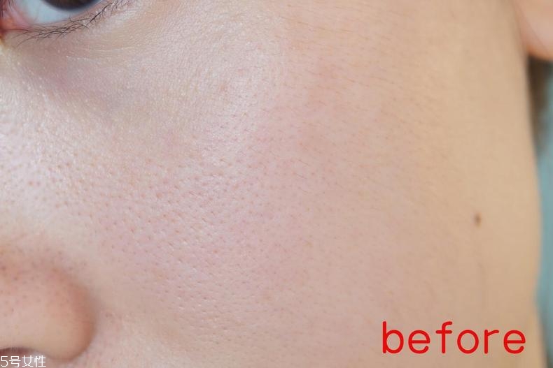 radha beauty vc精華白天能用嗎？敏感肌能用嗎？