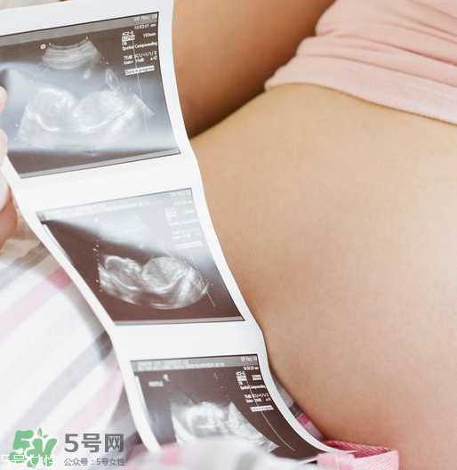 頭胎雙胞胎還能生二胎嗎？雙胞胎家庭能要二胎嗎？