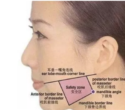 瘦臉針后多久可以化妝 瘦臉針后化妝會導(dǎo)致臉腫