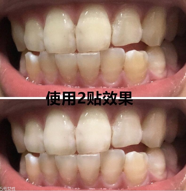 佳潔士美白牙貼貼多久有效？佳潔士美白牙貼使用感受