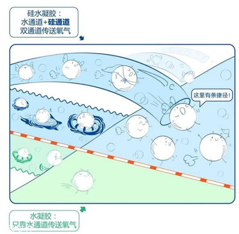 美瞳材質(zhì)哪種好 挑選不可盲目跟風