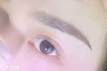 紋眉為什么會結痂 因為有傷口啊