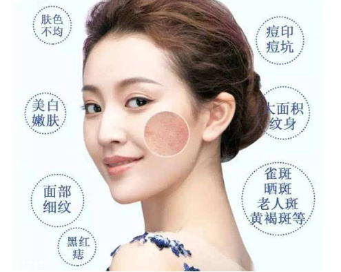 皮秒會反黑嗎 這是正?，F(xiàn)象