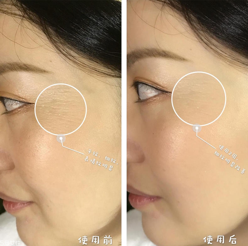 嬌韻詩(shī)黃金雙瓶真的有效果嗎 用上十年都不用換