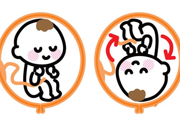 準(zhǔn)媽媽的十大常見(jiàn)煩惱