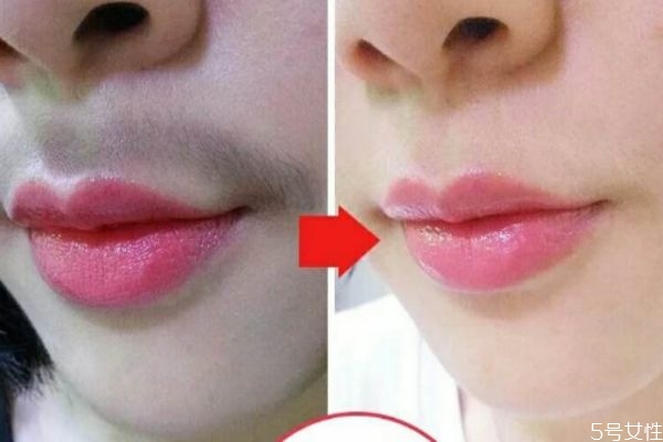 女性造成唇毛的原因是什么 為什么女性會(huì)長唇毛