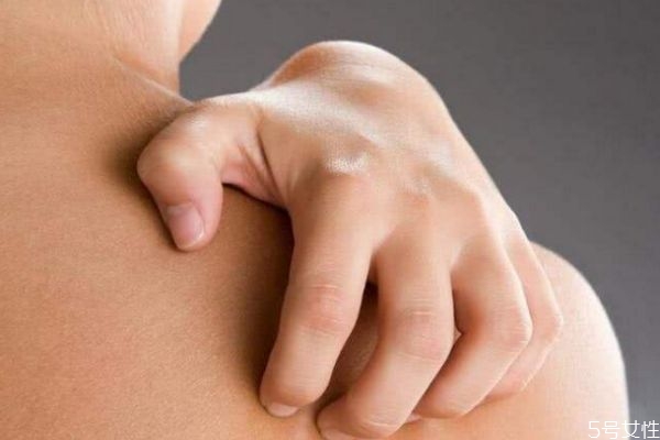 背上的痘痘應(yīng)該怎么去除 背上的痘痘應(yīng)該怎么去除