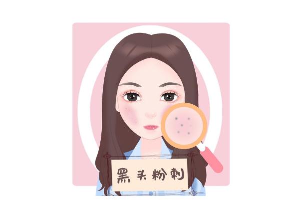 青春痘是怎么樣的 青春痘是螨蟲(chóng)引起的嗎