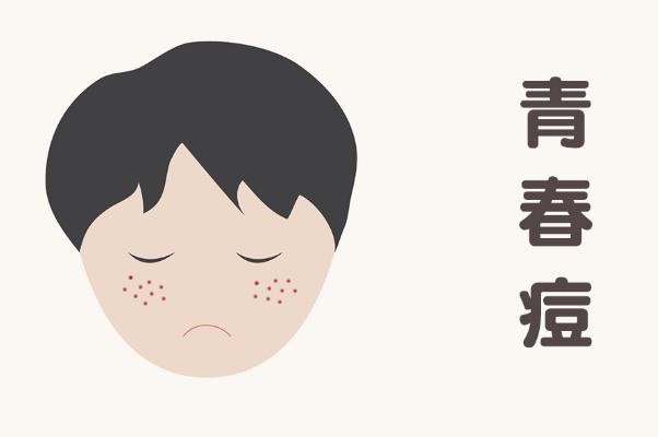 青春痘是怎么樣的 青春痘是螨蟲(chóng)引起的嗎