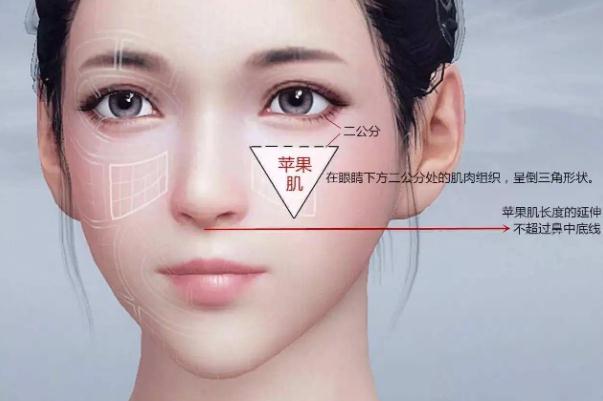 蘋(píng)果肌復(fù)位術(shù)怎么做 蘋(píng)果肌復(fù)位術(shù)可以保持多久