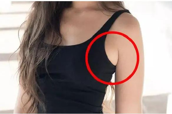 副乳切除手術什么季節(jié)做最好 副乳切除手術可以在整形醫(yī)院做嗎