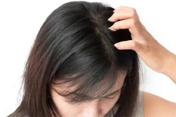 干性頭發(fā)怎么護(hù)理 干性頭發(fā)用有硅油的好一點(diǎn)還是用無硅油好