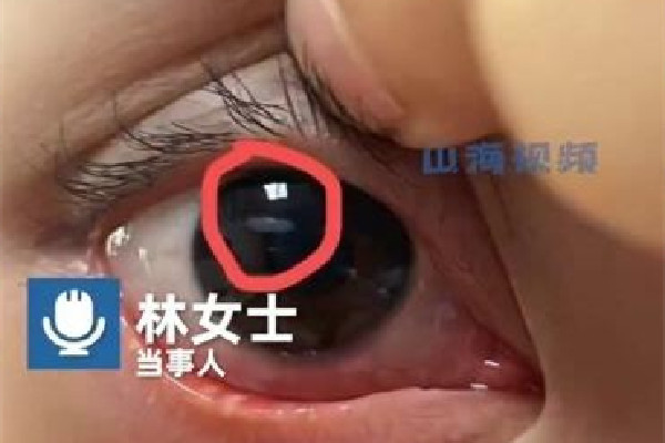 女生用發(fā)卡燙睫毛眼球燙個(gè)泡 燙睫毛對睫毛傷害大嗎