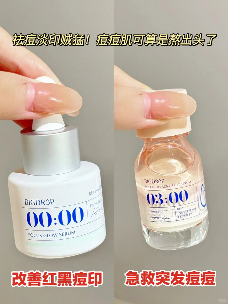 祛痘產(chǎn)品橫測：谷雨白千祛痘凝膠、大水滴與達爾膚杏仁酸，誰是祛痘王者？